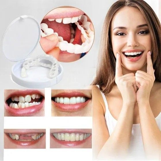 KIT COM 2 Placas Dentais de Cerâmica Removiveis Brancas – PARA TODAS ARCARIAS – Volte a ter um sorriso lindo como antes