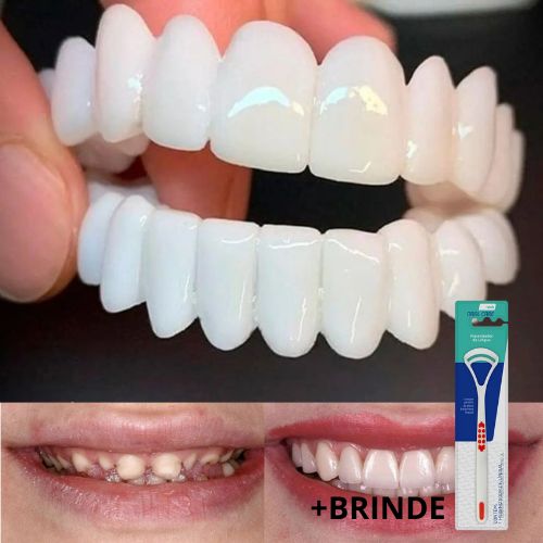 KIT COM 2 Placas Dentais de Cerâmica Removiveis Brancas – PARA TODAS ARCARIAS – Volte a ter um sorriso lindo como antes