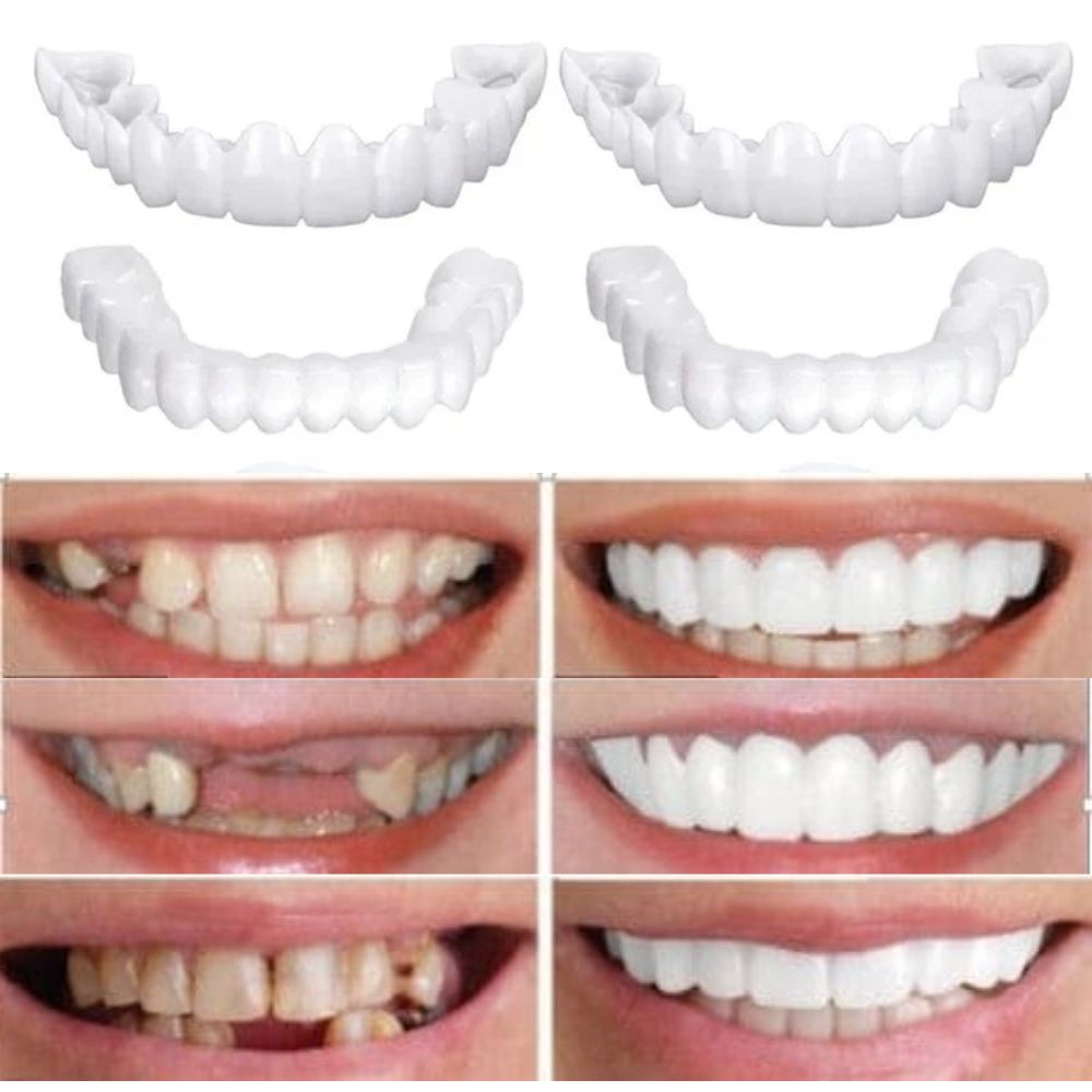 KIT COM 2 Placas Dentais de Cerâmica Removiveis Brancas – PARA TODAS ARCARIAS – Volte a ter um sorriso lindo como antes