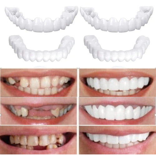 KIT COM 2 Placas Dentais de Cerâmica Removiveis Brancas – PARA TODAS ARCARIAS – Volte a ter um sorriso lindo como antes