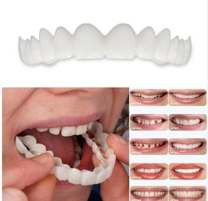 KIT COM 2 Placas Dentais de Cerâmica Removiveis Brancas – PARA TODAS ARCARIAS – Volte a ter um sorriso lindo como antes